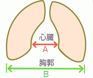 心胸比のについて