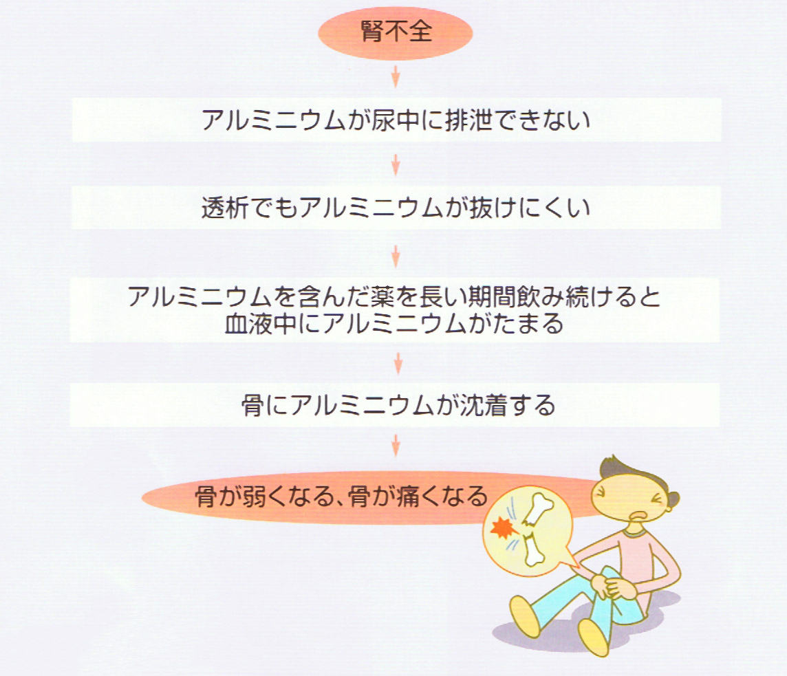 アルミニウム骨症の発症メカニズムを示すフローチャート。腎不全によりアルミニウムが尿中に排泄できず、透析でも抜けにくいため、アルミニウムを含んだ薬を長期間飲み続けると血液中にアルミニウムがたまり、骨に沈着することで骨が弱くなり痛みが生じる様子が示されている。