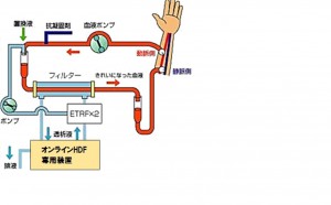OnHDF図